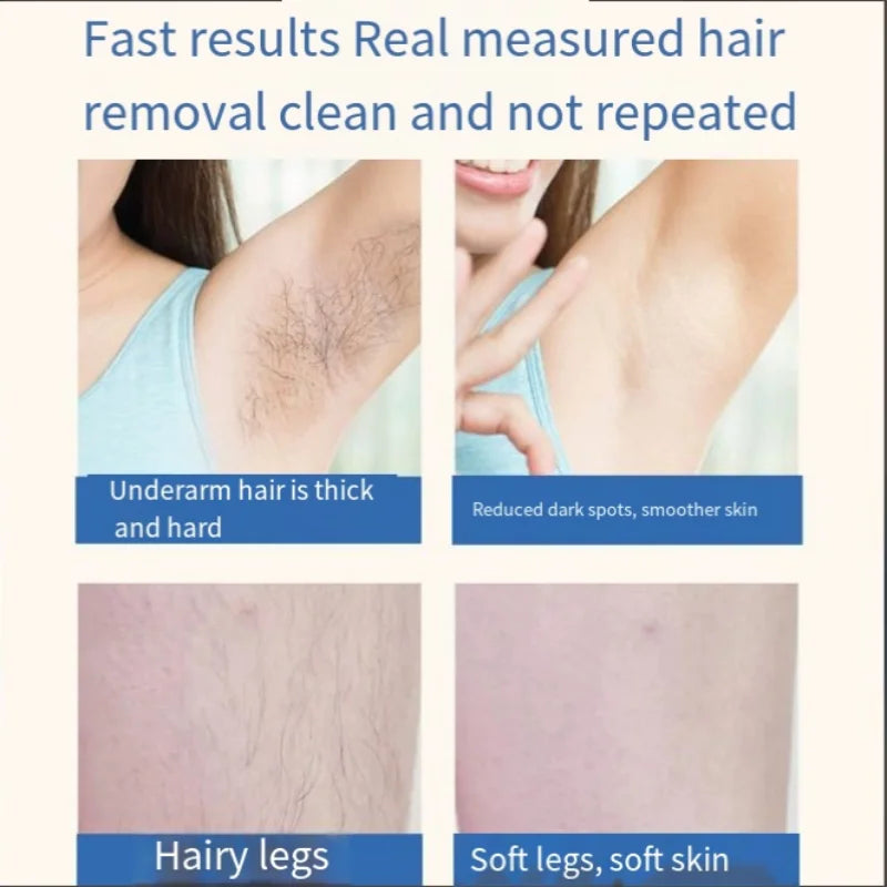 New IPL Hair Removal Laser Epilator For Women 500,000 Flash Depilator Pulses Permanent Laser Epilator Painless Hair Removal